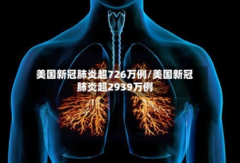 美国新冠肺炎超726万例/美国新冠肺炎超2939万例