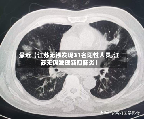 最近【江苏无锡发现31名阳性人员,江苏无锡发现新冠肺炎】