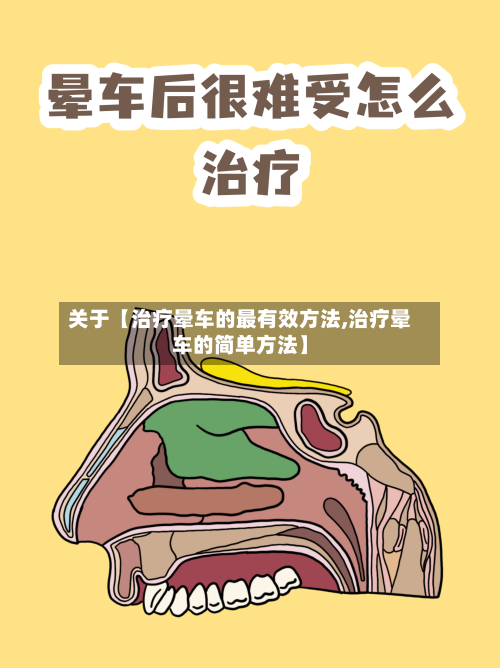 关于【治疗晕车的最有效方法,治疗晕车的简单方法】-第2张图片
