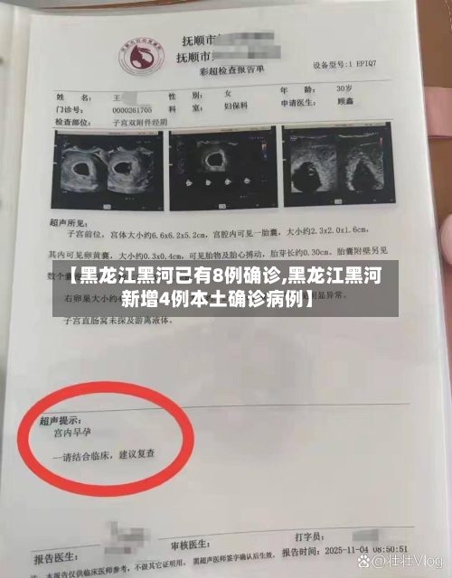 【黑龙江黑河已有8例确诊,黑龙江黑河新增4例本土确诊病例】-第3张图片