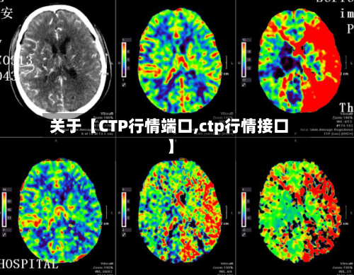 关于【CTP行情端口,ctp行情接口】-第3张图片