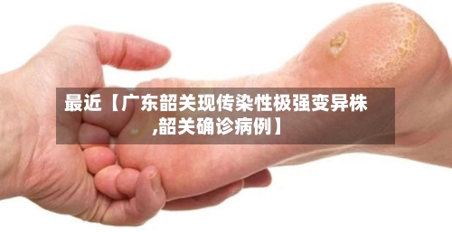 最近【广东韶关现传染性极强变异株,韶关确诊病例】