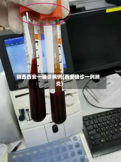 陕西西安一确诊病例(西安确诊一例肺炎)-第2张图片