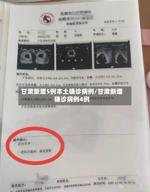 甘肃新增5例本土确诊病例/甘肃新增确诊病例4例
