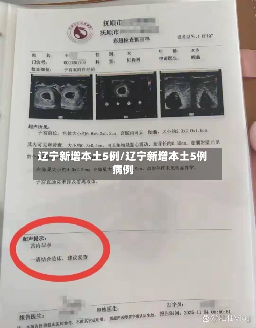 辽宁新增本土5例/辽宁新增本土5例病例-第3张图片