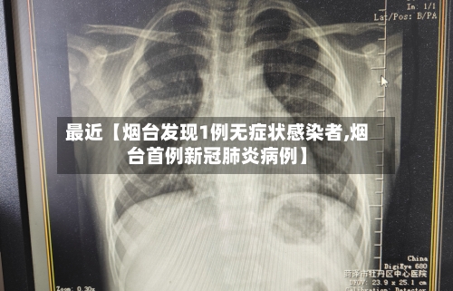 最近【烟台发现1例无症状感染者,烟台首例新冠肺炎病例】-第3张图片