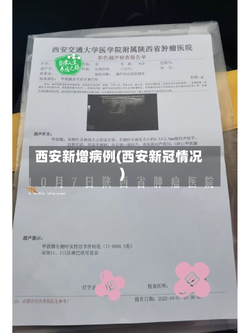 西安新增病例(西安新冠情况)-第3张图片