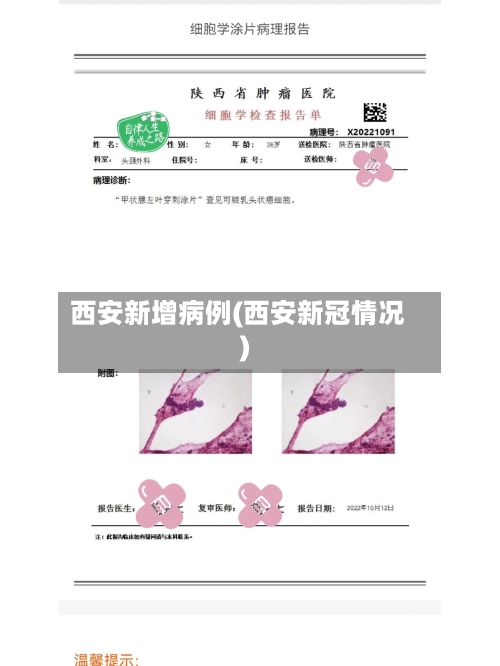 西安新增病例(西安新冠情况)-第2张图片