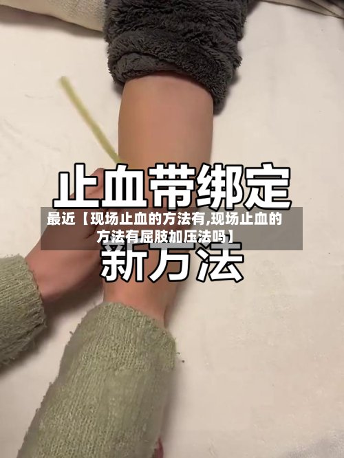 最近【现场止血的方法有,现场止血的方法有屈肢加压法吗】-第2张图片