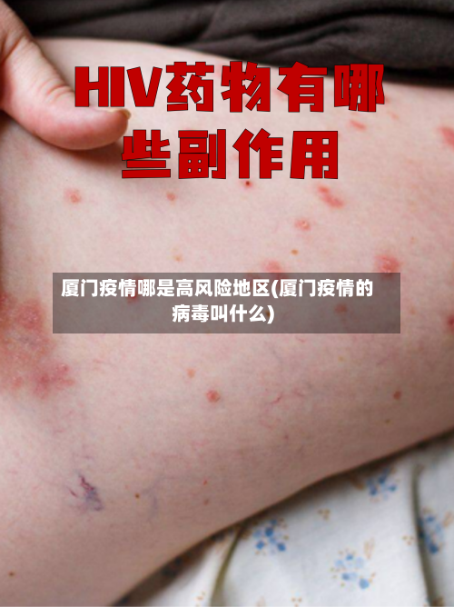 厦门疫情哪是高风险地区(厦门疫情的病毒叫什么)