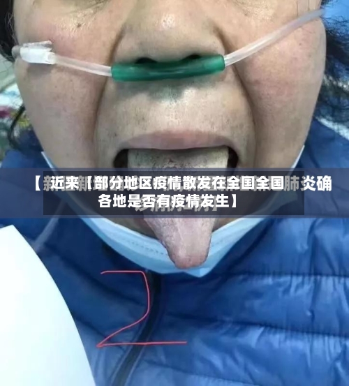 近来【部分地区疫情散发在全国全国各地是否有疫情发生】-第2张图片