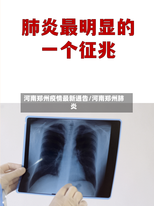 河南郑州疫情最新通告/河南郑州肺炎