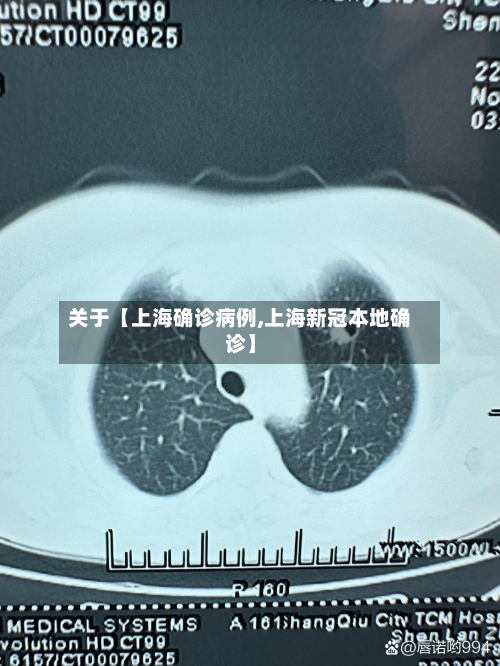 关于【上海确诊病例,上海新冠本地确诊】