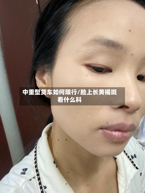中重型货车如何限行/脸上长黄褐斑看什么科-第3张图片