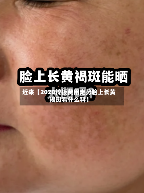 近来【2020镍板费用走势脸上长黄褐斑看什么科】-第2张图片