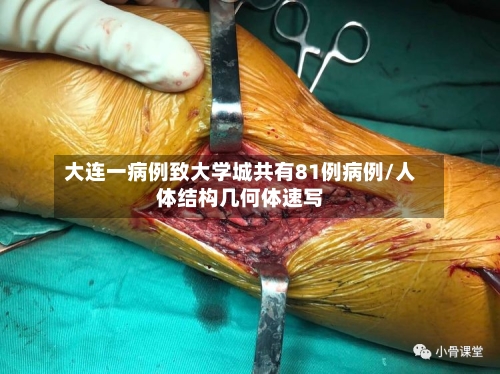 大连一病例致大学城共有81例病例/人体结构几何体速写