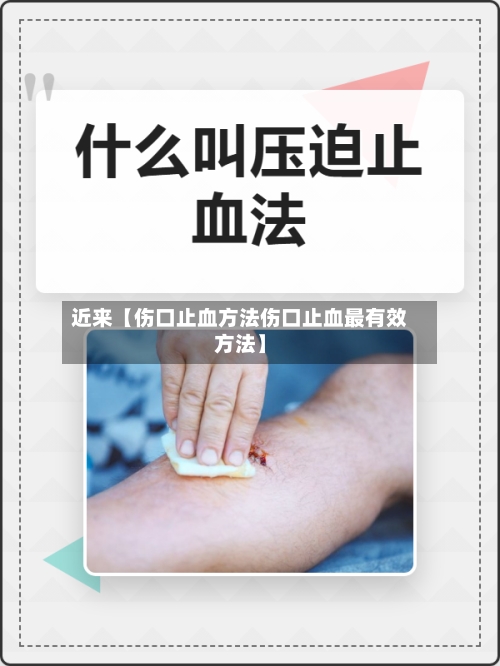 近来【伤口止血方法伤口止血最有效方法】-第2张图片